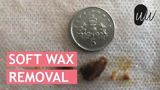 Soft Olive Oil Infused Ear Wax Removal - #364