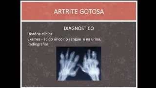 aula 2  Patologia Osteo articular