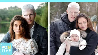Albino model brings baby to the world with his brunette wife