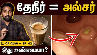 அல்சர் வரதுக்கு உண்மையான காரணம் என்னனு தெரியுமா! | The real reason behind ulcer | UYIRMEI EP-42