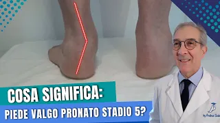 Cosa vuoldire Piede Pronato Valgo al 5° stadio? | Dott. Andrea Scala