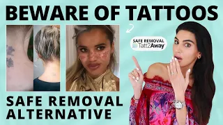 Laser Tattoo Removal Isn’t the Only Way to Remove Tattoos | Everything You Need to Know