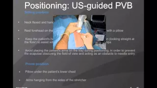 Webinar: Ultrasound-Guided Paravertebral Nerve Blocks