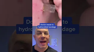 Doctor reacts to hydrocolloid patch removal! #dermreacts #doctorreacts #hydrocolloidpatch