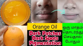 skin Pigmentation/ How to Remove pigmentation from the face Naturally/gayus lifestyle