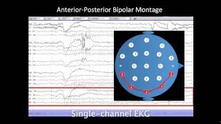 Introduction to EEG