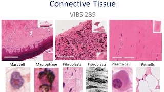 Medical School Histology Basics - Connective Tissue