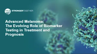 Advanced Melanoma: The Evolving Role of Biomarker Testing in Treatment and Prognosis