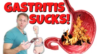 Gastritis - A Different Viewpoint