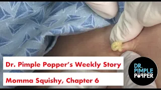 Dr. Pimple Popper's Weekly Story Time: Momma Squishy, Chapter 6