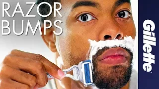 Help Prevent Razor Bumps & Ingrown Hairs | Gillette SkinGuard