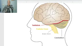 Anatomy for applied medical science(Radiology Department) 6 (Dural folds), by Dr.Wahdan