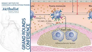 Precision Medicine for Cardiovascular Prevention (Christie M. Ballantyne, MD) June 27, 2019