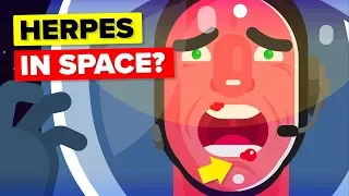 Why Are Astronauts Getting Herpes When Going to Space?