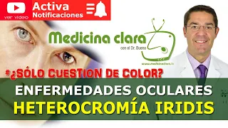 Heterocromía iridis: Ojos de cada color. ¿Qué enfermedad puede ocultar? | MedicinaClara