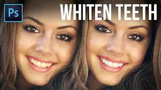 3 Super Realistic Techniques to Whiten Teeth in Photoshop