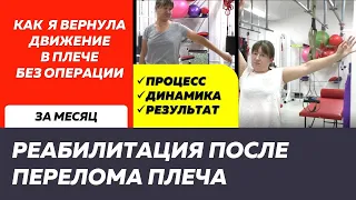 Дневник лечения сложного перелома плеча. Рука снова поднимается!