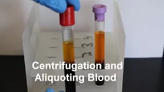 Centrifugation and Aliquoting of Blood Serum and Plasma