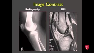 Medical Student Lecture: Introduction to Musculoskeletal Imaging