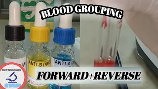 forward & reverse typing_blood typing (tube method)