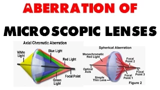 Aberration of microscopic lenses | chromatic aberration, spherical aberration and coma effect