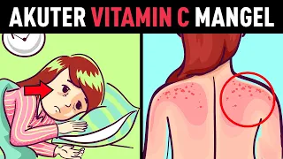 6 häufige ANZEICHEN von VITAMIN C Mangel, die du nicht ignorieren solltest!