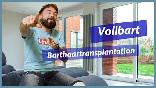 Barthaartransplantation in der Türkei | 8 Monate Post Op Update