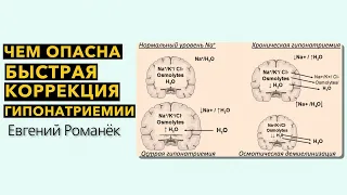 Чем опасна быстрая коррекция гипонатриемии