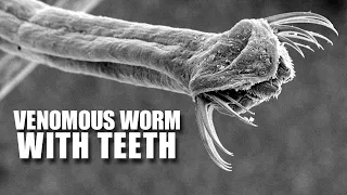 Arrow Worm Facts: a VENOMOUS WORM with TEETH 😬 Animal Fact Files
