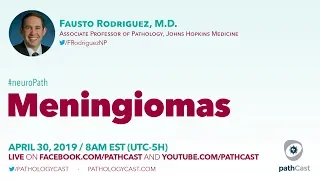 Meningiomas - Dr. Rodriguez (Hopkins) #NEUROPATH