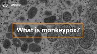 What is monkeypox and how dangerous is it?