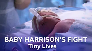 Premature Baby Harrison Requires Emergency Resuscitation | Tiny Lives | BBC Scotland