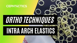 Intra Arch Elastics in Orthodontics