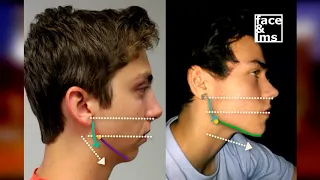 WAW5: What Makes A Male Jaw Attractive