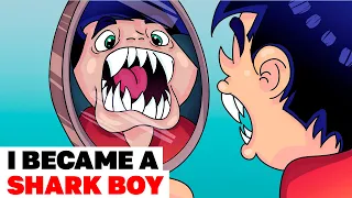 I Became a Shark Boy by Implanting Shark Teeth | Animated Story about teeth