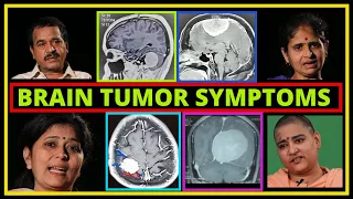 What are the symptoms of Brain Tumour?