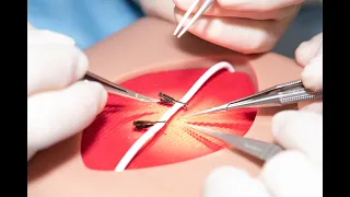 Microvascular Anastomosis  Tips and Techniques [long version]