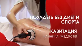 Похудеть без диет и спорта. Миф или реальность? Алла Довлатова в клинике МедЭстет.