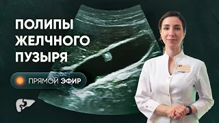 Что нужно знать о полипах желчного пузыря?