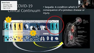 11/17/23 - Current Controversies in Long COVID: It's More Than a Name