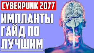 ИМПЛАТЫ ▶ ГАЙД И ОБЗОР В КИБЕРПАНК ▶ АНАЛИТКА ▶ CYBERPUNK 2077 ▶ ОБУЧЕНИЕ, СОВЕТЫ И СЕКРЕТЫ