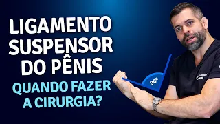 Ligamento Suspensor do Pênis: Quando Fazer a Cirurgia? | Dr.  Marco Túlio Cavalcanti