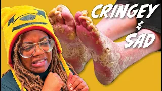 WORST feet I've ever Seen! | AyChristene React