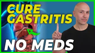 HOW to CURE GASTRITIS without medications? - DR. CARLOS