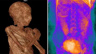 Forscher untersuchen Mumie im Sarg eines Hohepriesters – und finden eine schwangere Frau