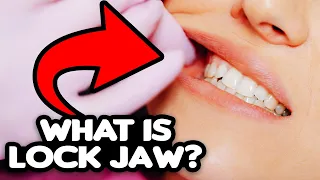 Lock Jaw Explained (causes, treatment, prevention)