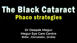 Phaco Strategies for dense cataract (Grade 5) - Dr Deepak Megur