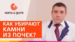 💎Новейшие методы удаления камня из почки и лечения мочекаменной болезни. Удалить камень из почки.18+