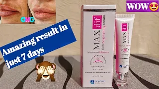 MAX diff skin brightening cream review, price & my experience || LABZ REVIEWS ||