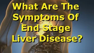 What Are The Symptoms Of End-Stage Liver Disease?